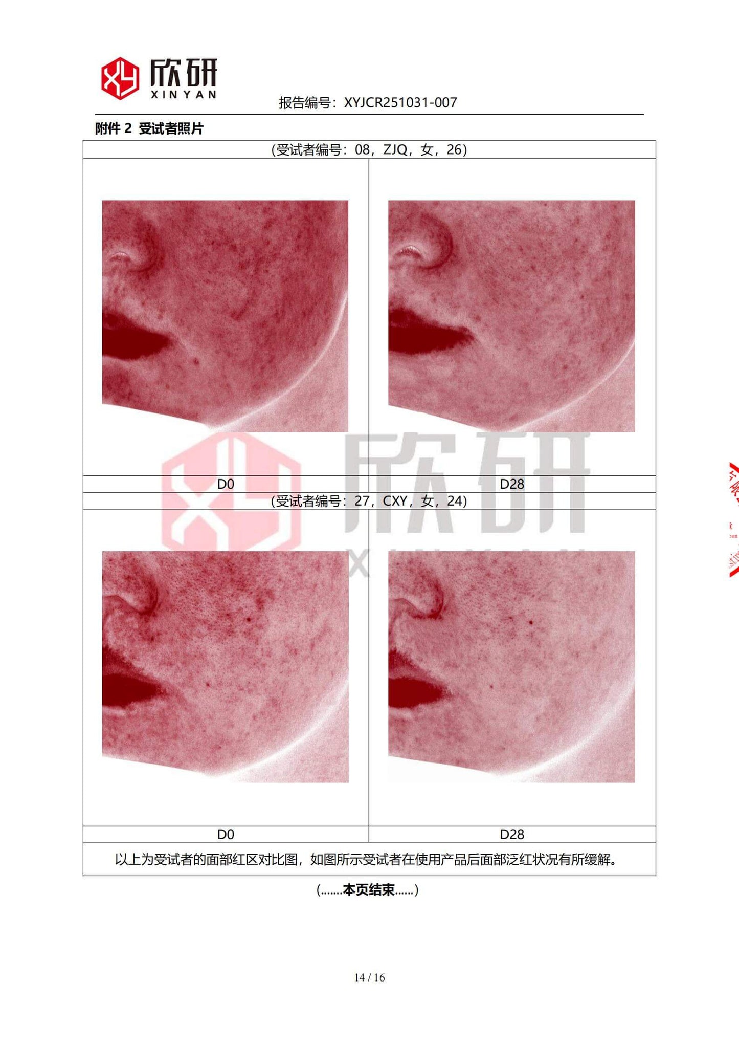 森林颜华黑玫瑰時光精華乳｜安全溫合修護敏感肌膚專用｜改善干癢泛紅｜強韌屏障